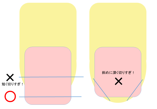 巻き 爪 の 切り 方